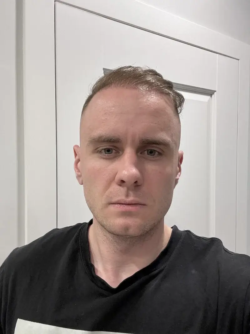 Before — original selfie